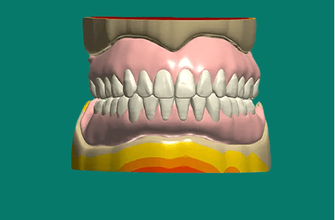 Close-up of a detailed dental crown model.