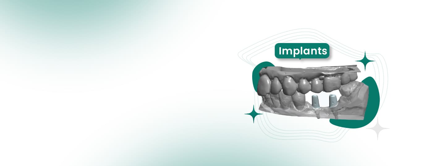 Confidence You Can Count On