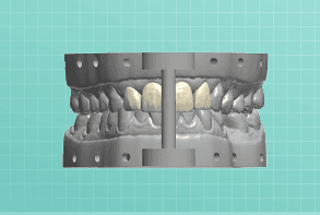 Full Arch Models dental prosthesis