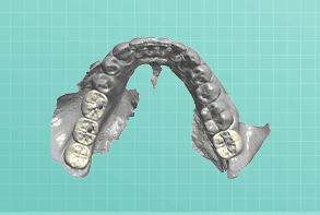 Removable Prosthodontics
